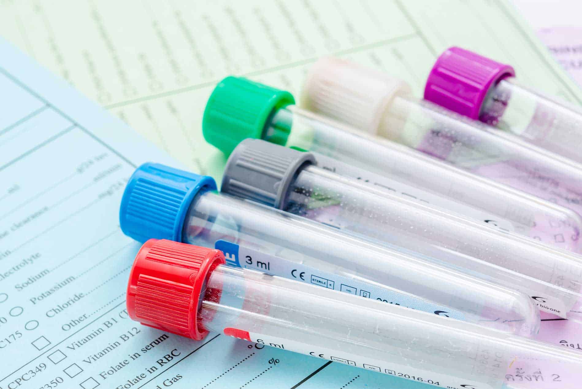 Autologous-Blood-Injections-Treatment