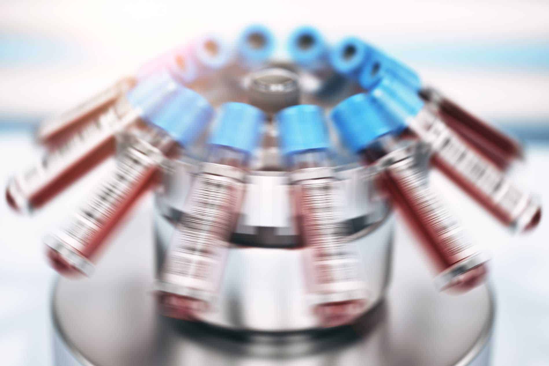 PRP---Platelet-Rich-Plasma-Injections