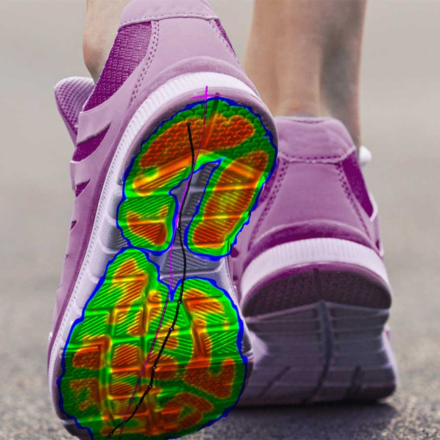 Phit3D-print-custom-orthotics