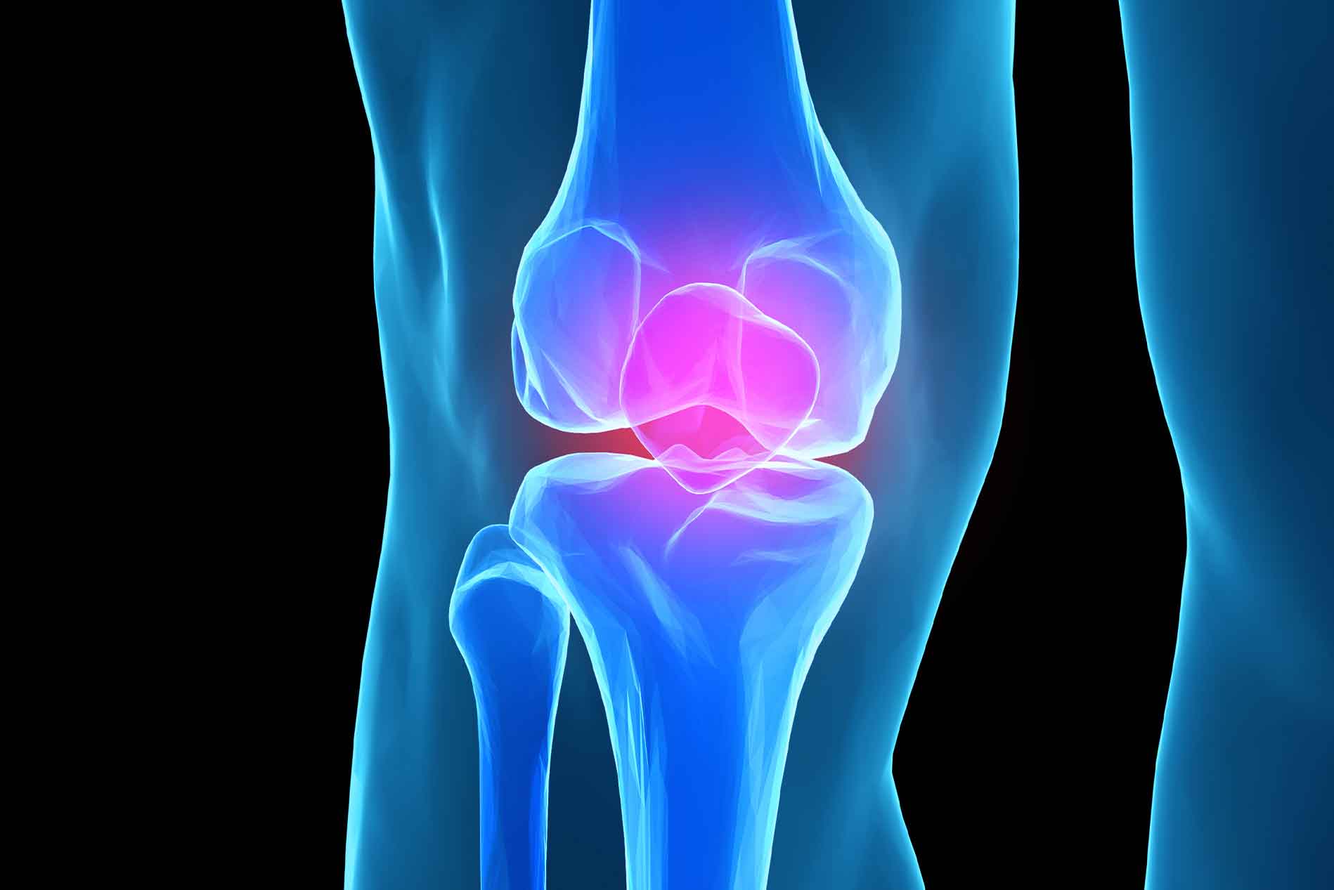 What-is-a-knee-genicular-nerve-radiofrequency-treatment