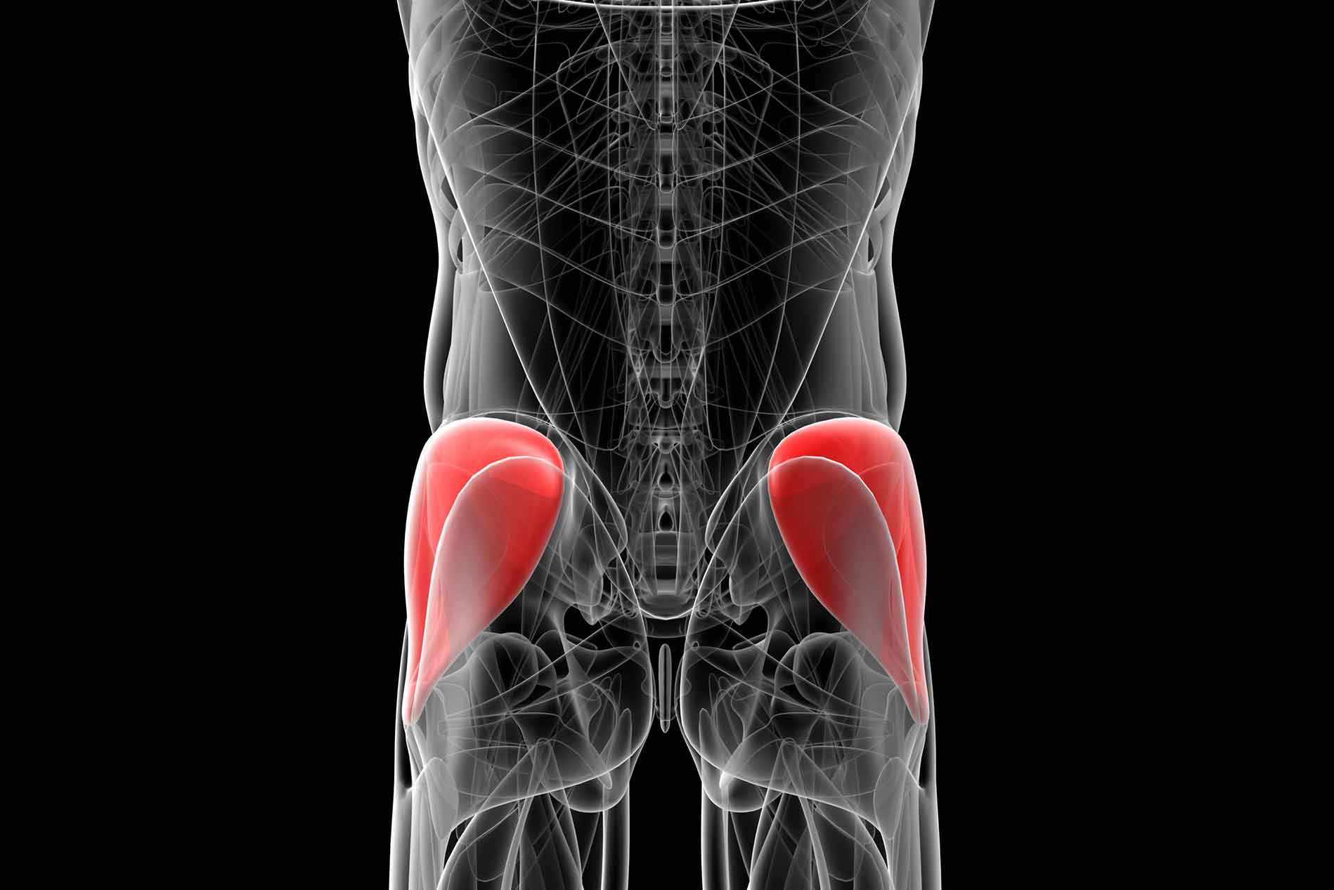 it-could-be-deep-gluteal-syndrome