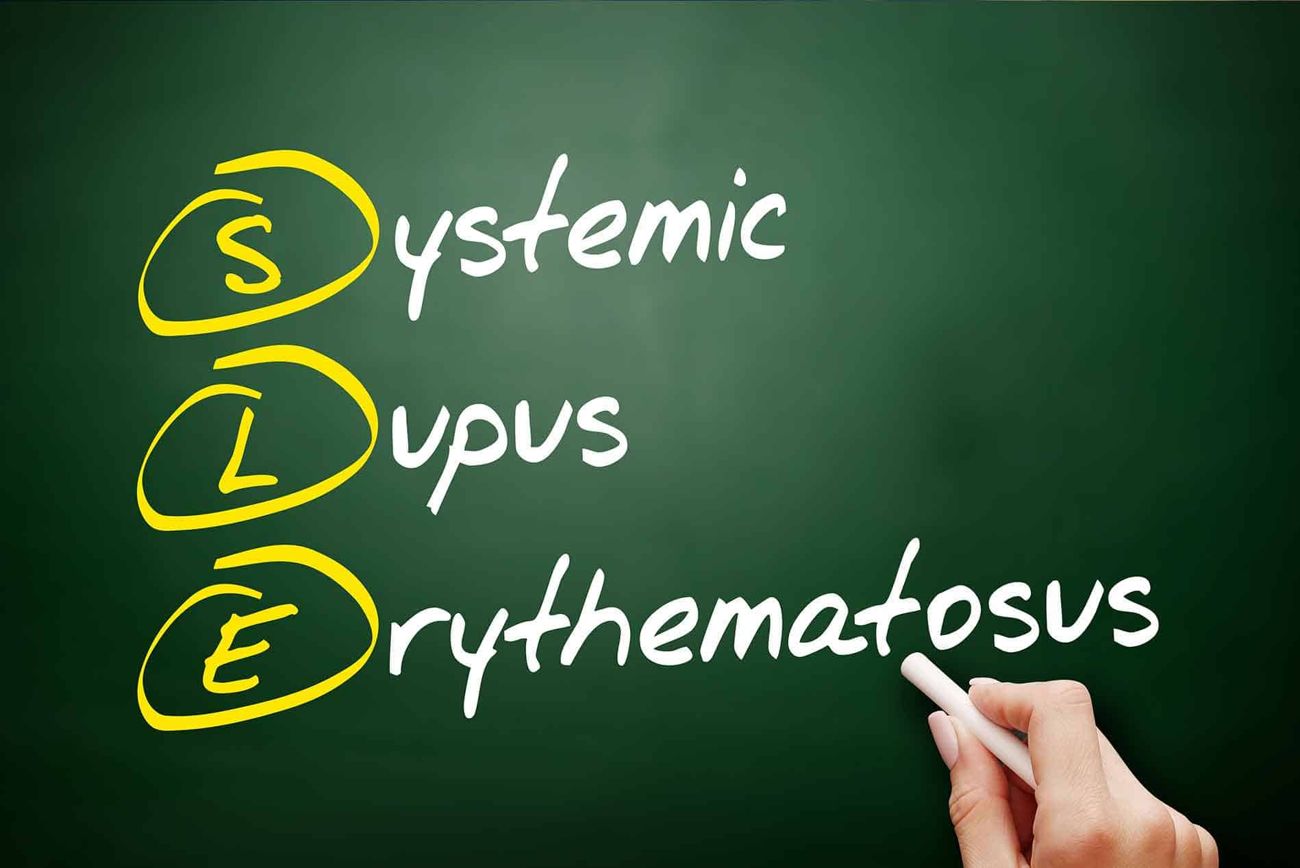 systemic-lupus-erythematosus