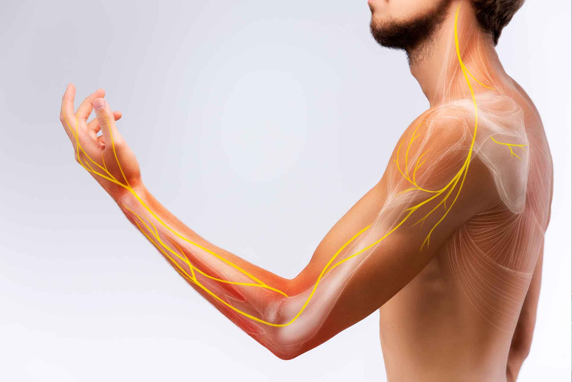 what-is-thoracic-outlet-syndrome